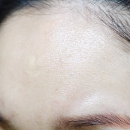 NMN앰플 파니 여름철 광노화 피부관리 예방법