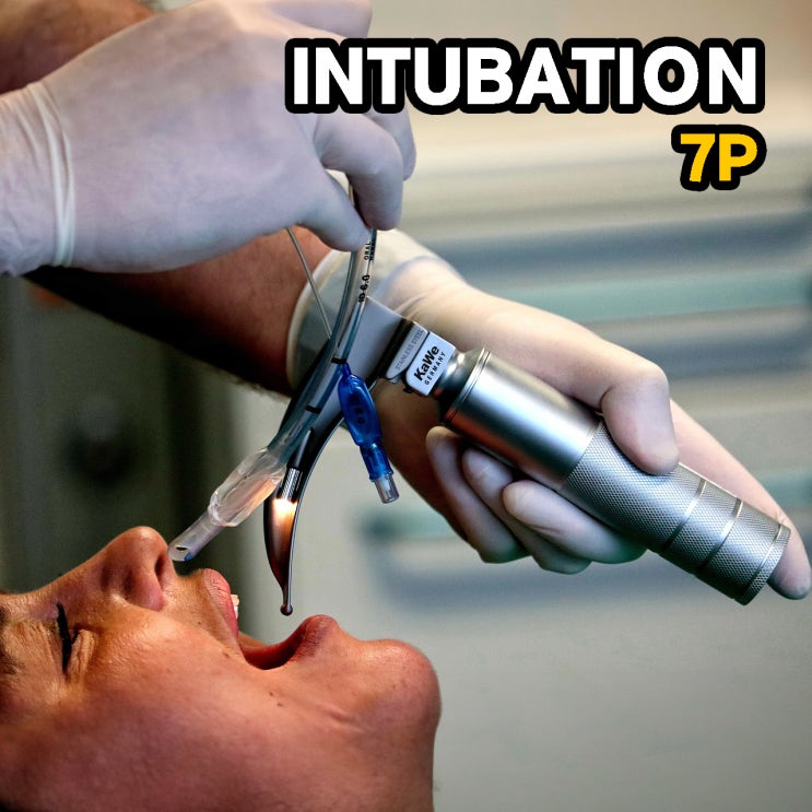 RSI(Rapid Sequence Intubation) 7P로 알아보는 기관내삽관과정 : 네이버 블로그