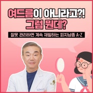 피지낭종과 여드름의 차이점? 확실하게 알아보자!