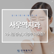 사우역치과 이시림 증상, 치경부 마모증 의심해봐야 하는 이유