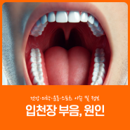 입천장 부음 물집 원인 해결 방법