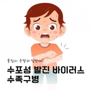 아기 수족구 증상 초기 전염 예방은 이렇게!