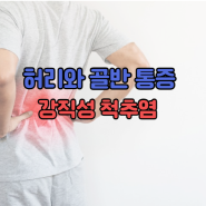 [부발 필라테스] 아침마다 허리가 뻣뻣하다면? 강직성 척추염을 의심해 보세요