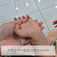 서울/용산_ 김형석 소아과 (34개월 수족구 의심 초기증상)