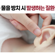 여름철 물놀이 시, 안전하게 귓속 물 제거하는 법