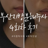 부산 지방분해주사 리포사 4회차 후기 (이중턱 턱살 뱃살 주사 비포 에프터 확실!)