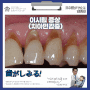 이시림 증상: 치아 민감증(상아질 과민증) Tooth Sensitivity
