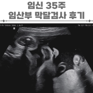 임신 35주 임산부 막달검사 후기