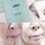 팔자주름없애기 뷰티영 DNA 팔자주름패치 추천