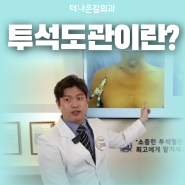 중심정맥관, 투석도관, 카테터란?