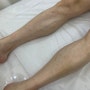 포항 우현동 왁싱 멜팅왁싱 남자 다리 하프 후기