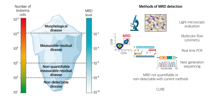 미세잔존질환(Minimal Residual Disease, MRD) 검출을 위한 유세포검사(Flow Cytometry ...