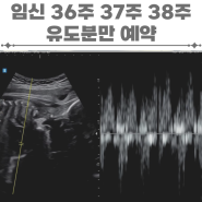 임신 36주 37주 38주 유도분만 예약