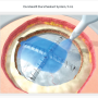 경막봉합용 접착제 (Duraseal Dural Sealant System 등) 인정기준