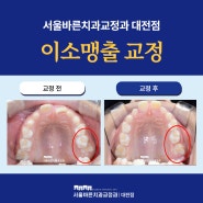 대전교정치과 아이 어금니가 안 나와요, 이소맹출 교정 증례