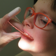 치아가 조금 비뚤어져 있는데 자라면서 정상적으로 저절로 개선이 될까요? 부정교합 치료 시기