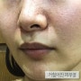 피부면역력 저하피부 특징 : 피부면역 높이는 방법 공유