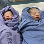 쌍둥이 일과성 과호흡(빈호흡): 강남 세브란스 신생아중환자실( NICU :니큐) 치료, 입원비 정보공유