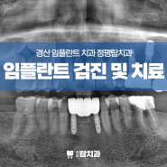 임플란트 아픈가요 통증 걱정된다면 안아픈 임플란트