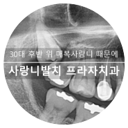 광교 수원 사랑니발치 치과 30대 후반 위 매복 사랑니로 인접치아 인접면 우식 충치 인레이 2차 우식 통증 신경치료 크라운