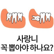 사랑니를 꼭 뽑아야 하나요?