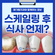 안양 치과 스케일링 후 밥 언제부터