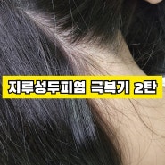 [망할 지루성두피염 극복기 2탄] 두피건강을 위한 두피케어제품_헤드엔숄더 클리니컬 스트렝스