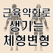 근육약화로 생기는 체형변형 ㅣ김포자세교정