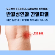 청주오금통증/오금 뜨끔 통증 반월상연골 견열파열의 치료방법