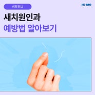 드문드문 보이는 새치, 하이모가 새치의 원인과 예방법을 알려드려요!