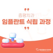 증평치과 임플란트 식립 과정이 궁금하신가요?