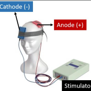 직류 자극술 tDCS 준비사항 및 부작용