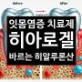 히아로겔 - 잇몸염증에 바르는 히알루론산 잇몸치료제 _아산 광은약국