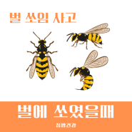 벌에 쏘였을때 증상 및 응급처치 약 병원 총정리