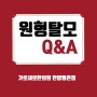 원형탈모 환자분들이 많이 하는 질문 Q&A 모음 (범계역 원형탈모 병원)