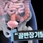 자궁탈출증 증상 매일 10분 운동으로 관리하세요