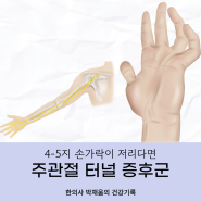 주관절 터널 증후군, 척골신경 포착 원인과 치료