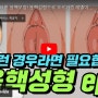 음핵수술 필요한 경우는