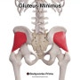 [과천재활] 가짜 좌골신경통의 원인 소둔근(Gluteus Minumus)에 대하여