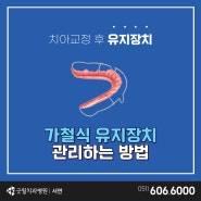 부전동교정치과 가철식 유지장치 관리법 알아보기