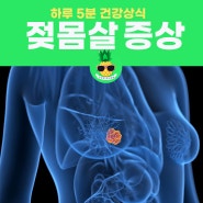 산모 젖몸살 증상, 마사지, 예방법, 유축, 약, 단유