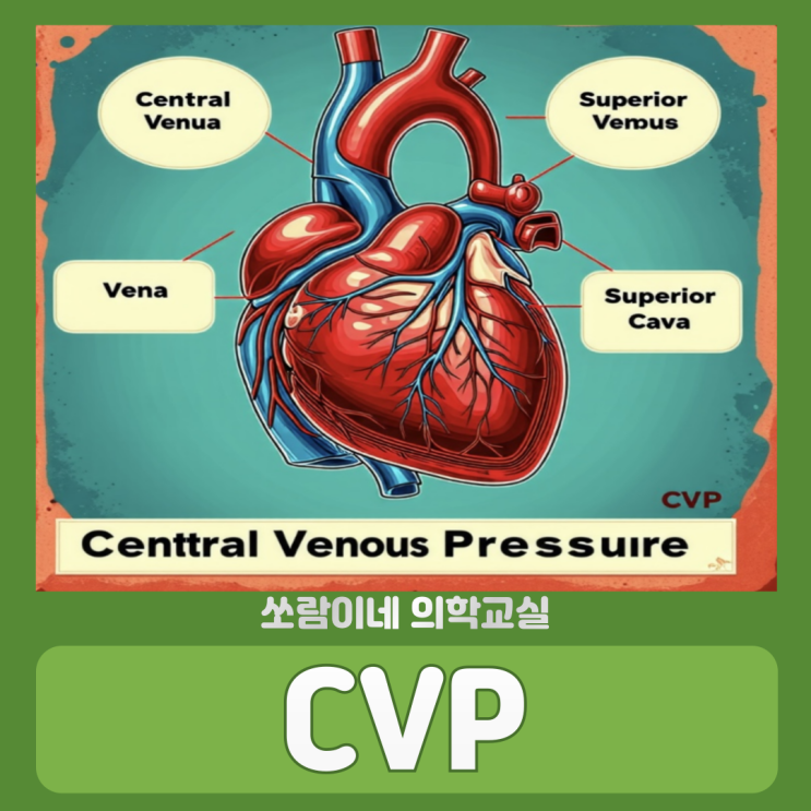 CVP 측정방법 의학용어 뜻 정상범위 : 네이버 블로그