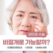 대구상안검수술 비절개로 가능할까?