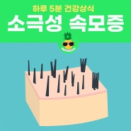 블랙헤드 속에 털? 소극성 속모증 원인, 증상, 진단, 치료(레이저)