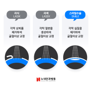 빠른 회복과 난시교정에 유리한 스마일수술 방법은?