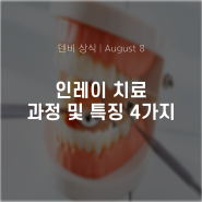 인레이치료 과정 및 특징 4가지 꼭 살펴보세요