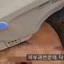 [삼성중앙역피부과] 아이울쎄라 효과 -3가지 적용 범위