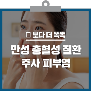 붉은 얼굴이 따끔따끔!주사 피부염 증상과 예방법