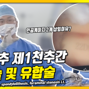 수술라이브)양방향척추내시경 척추유합술과 감압술 시행_부산큰병원 최승현 병원장