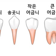 치아의 기능과 모양에 따른 치아별 역할